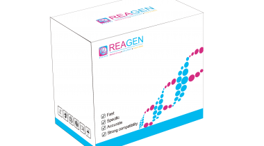 對(duì)蝦傳染性肌肉壞死病毒(IMNV)RNA恒溫核酸檢測(cè)試劑盒（不含提?。? />
                            </a>
                        </div>
                                            </div>
                </div>
                <div   id="zn57rpxt3vf"   class="col-lg-5">
                    <div   id="zn57rpxt3vf"   class="product-intro">
                        <h1 class=